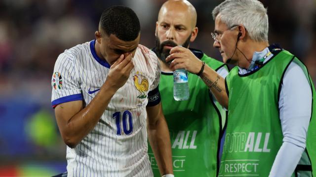 开云体育在线-姆巴佩鼻骨骨折但暂无需手术 或缺席2场小组赛